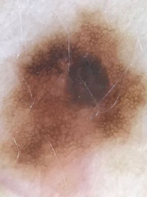 Moles