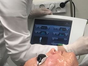 Intense pulsed light (IPL) treatment