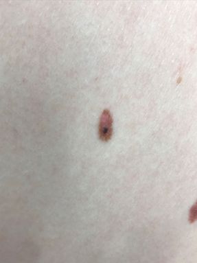 Changes in moles
